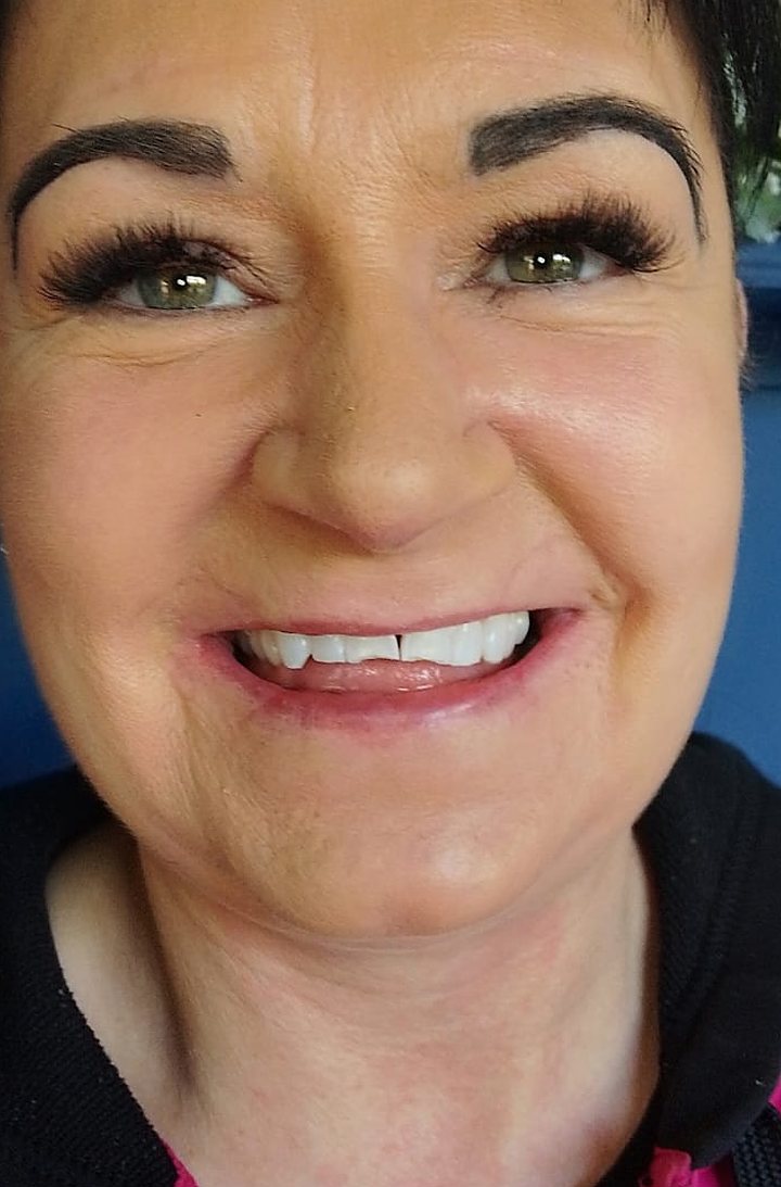 Smiling Lumiere client after teeth whitening at the Kildare studio