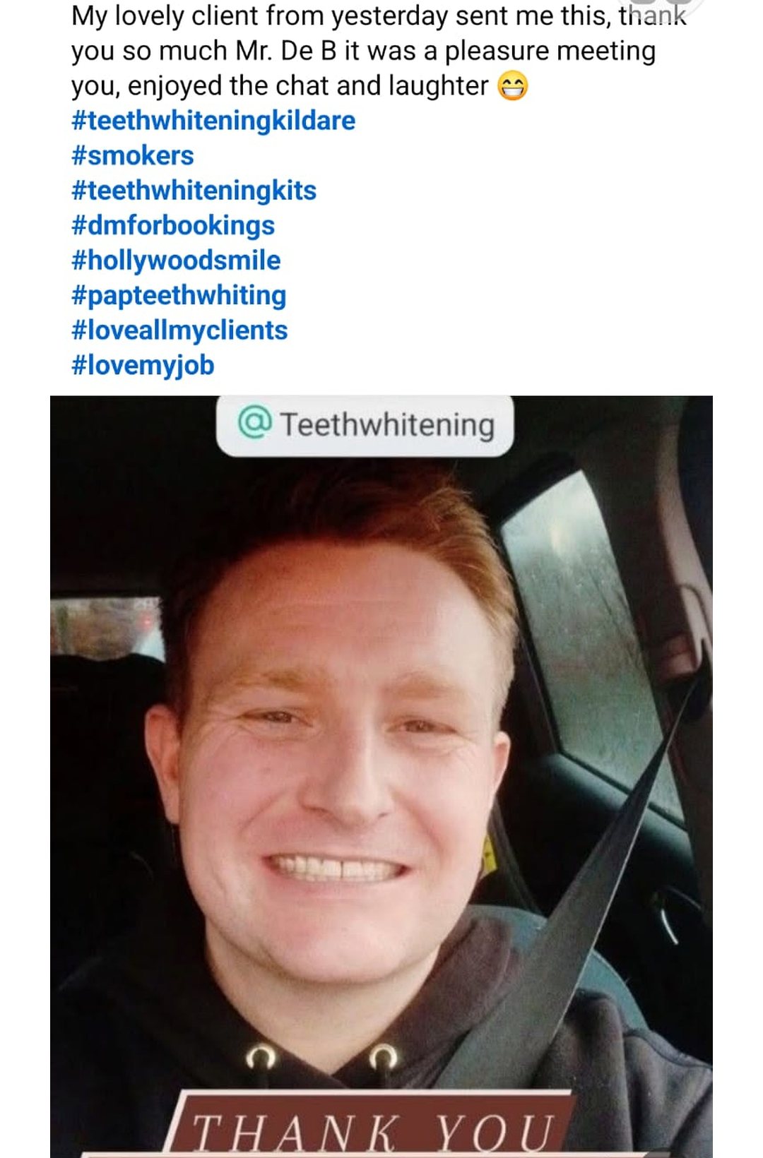 Lumiere teeth whitening before and after posted on Facebook as Teethwhitening Kildare on 12 Dec 2025. A lovely thank-you from a happy client.