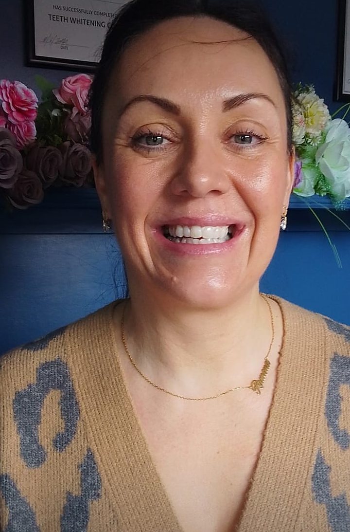 Smiling Lumiere client after teeth whitening at the Kildare studio