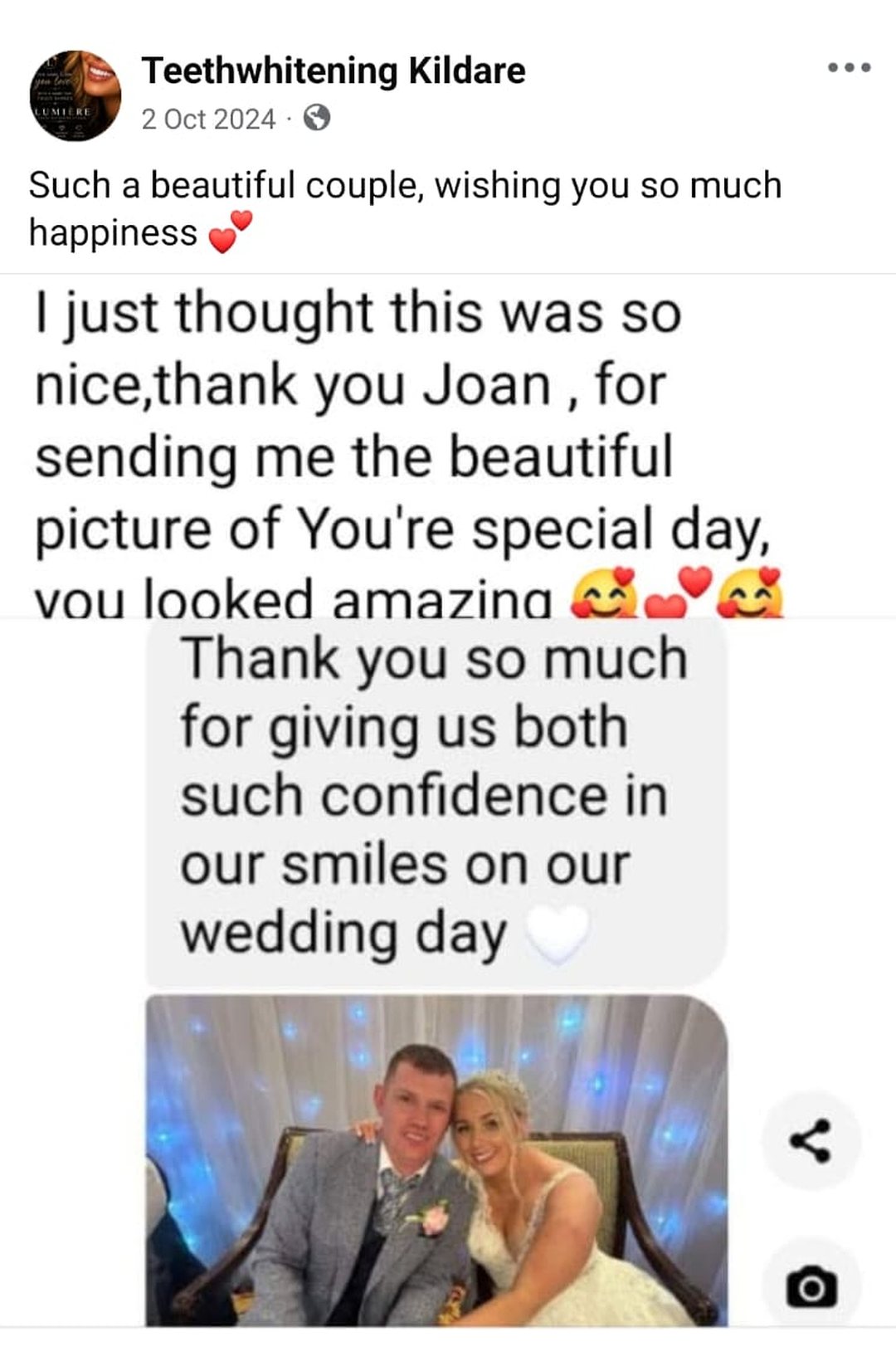Lumiere teeth whitening before and after posted on Facebook as Teethwhitening Kildare on 2 Oct 2024. "Such confidence in our smiles on our wedding day." — Joan