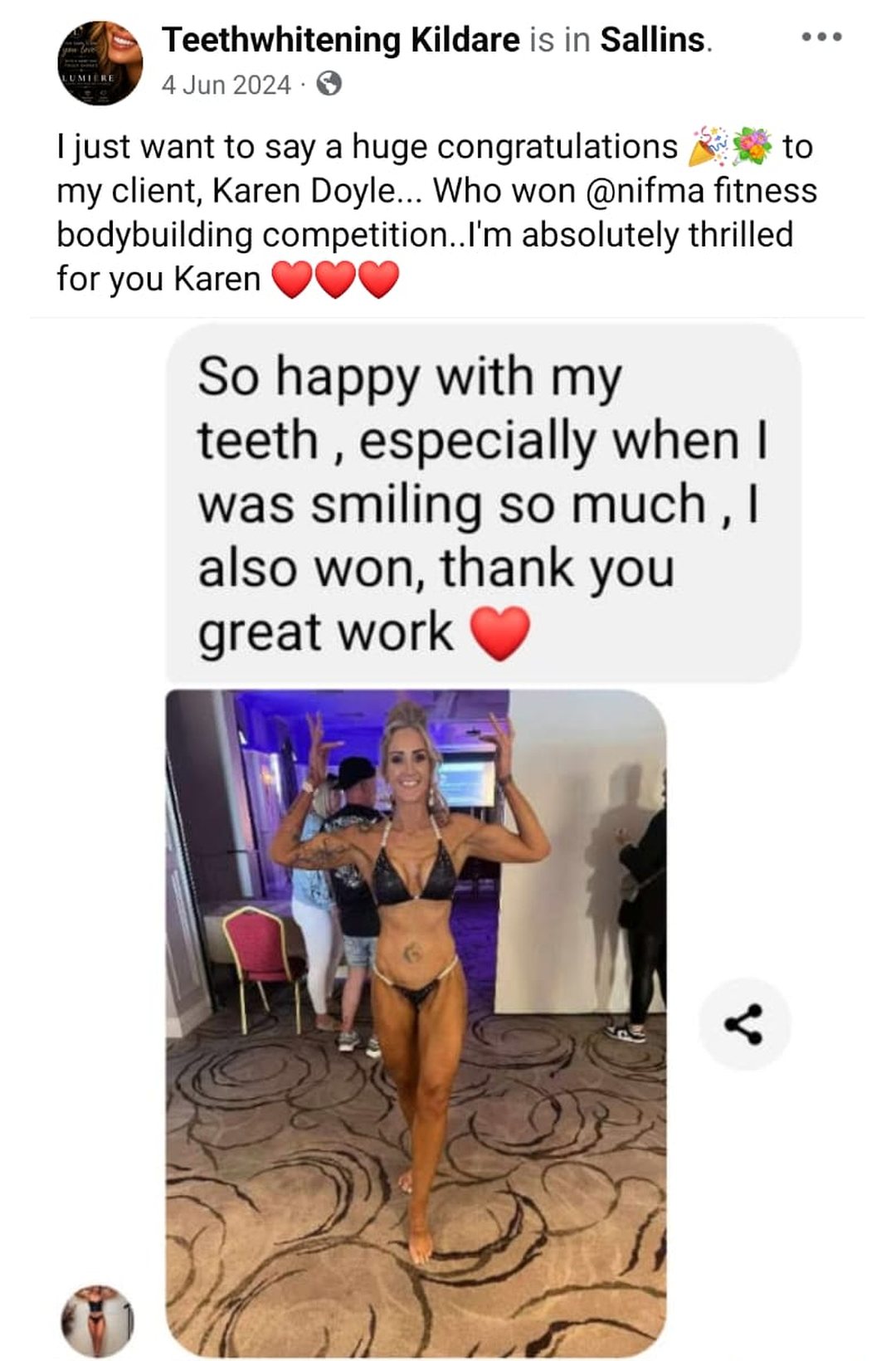 Lumiere teeth whitening before and after posted on Facebook as Teethwhitening Kildare on 4 Jun 2024. "So happy with my teeth… I also won, thank you." — Karen Doyle