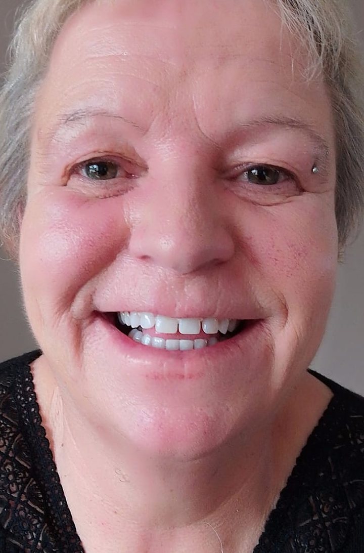 Smiling Lumiere client after teeth whitening at the Kildare studio