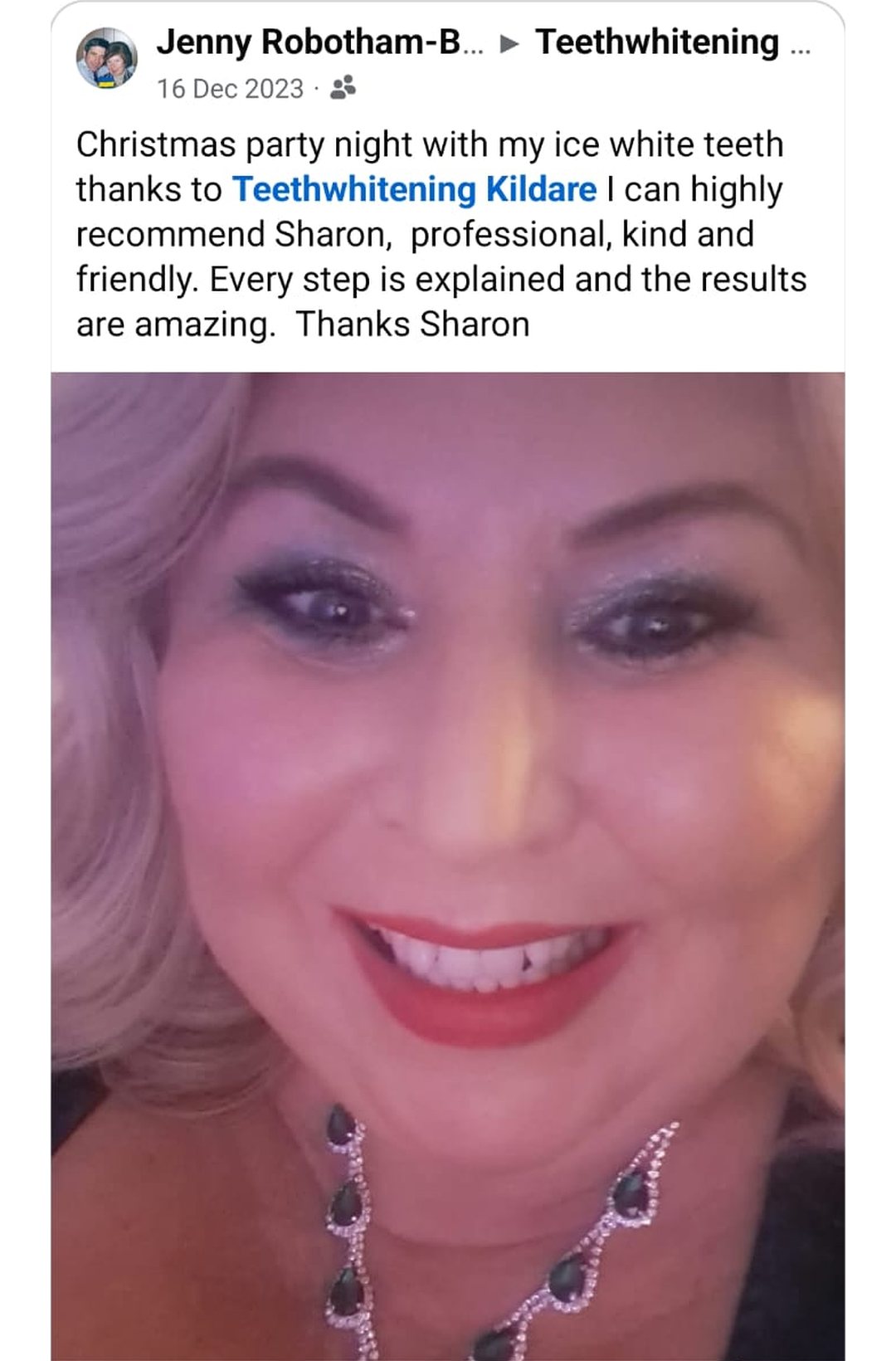 Lumiere teeth whitening before and after posted on Facebook as Teethwhitening Kildare on 16 Dec 2023. "Professional, kind and friendly… the results are amazing." — Jenny