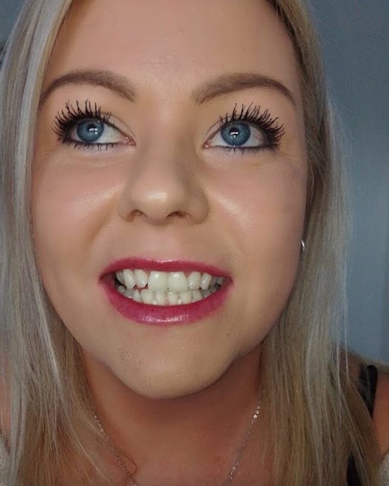 A smiling Lumiere teeth whitening client in Kildare.