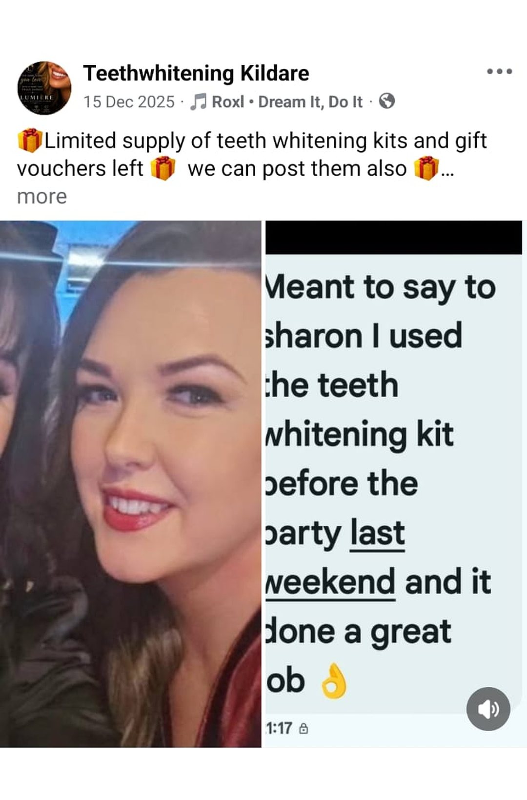 Lumiere teeth whitening before and after posted on Facebook as Teethwhitening Kildare on 15 Dec 2025. "I used the teeth whitening kit before the party… done a great job."