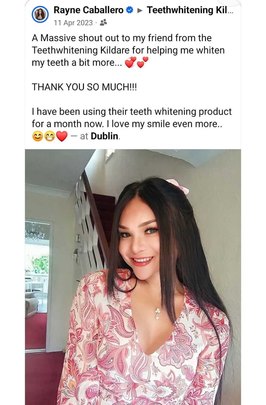 Lumiere teeth whitening before and after posted on Facebook as Teethwhitening Kildare on 11 Apr 2023. "I love my smile even more." — Rayne Caballero