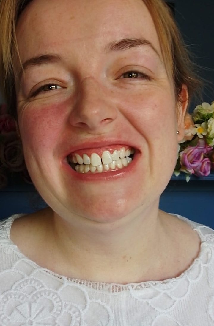 Smiling Lumiere client after teeth whitening at the Kildare studio
