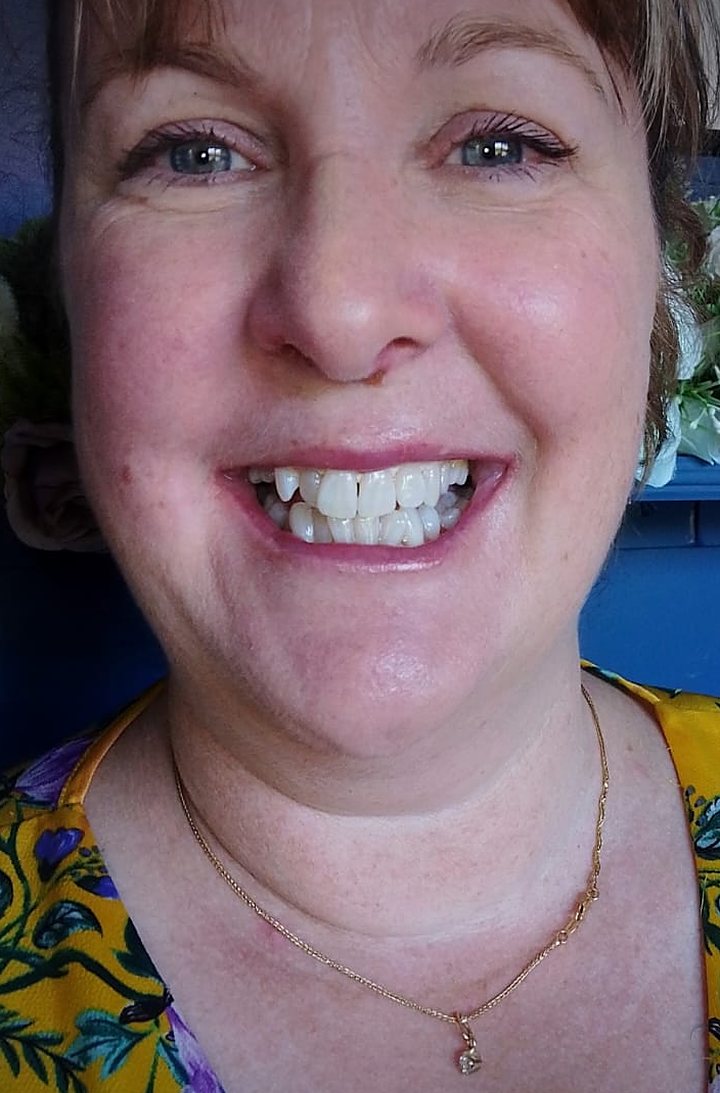 Smiling Lumiere client after teeth whitening at the Kildare studio