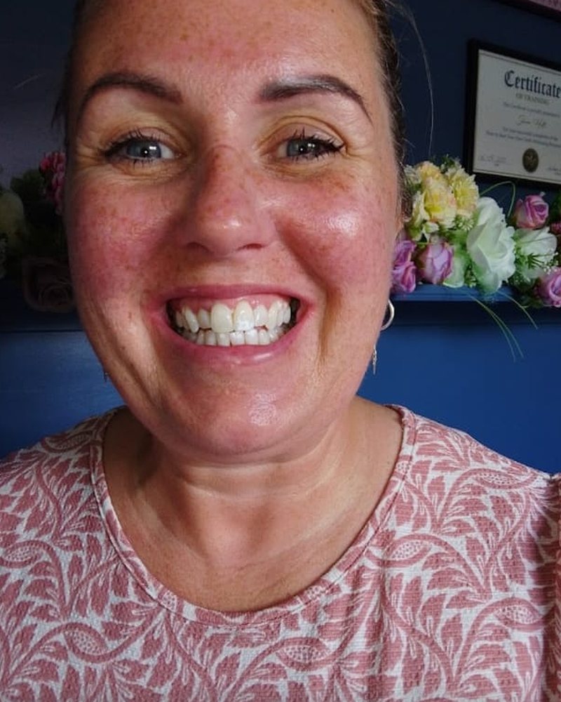 A smiling Lumiere teeth whitening client in Kildare.