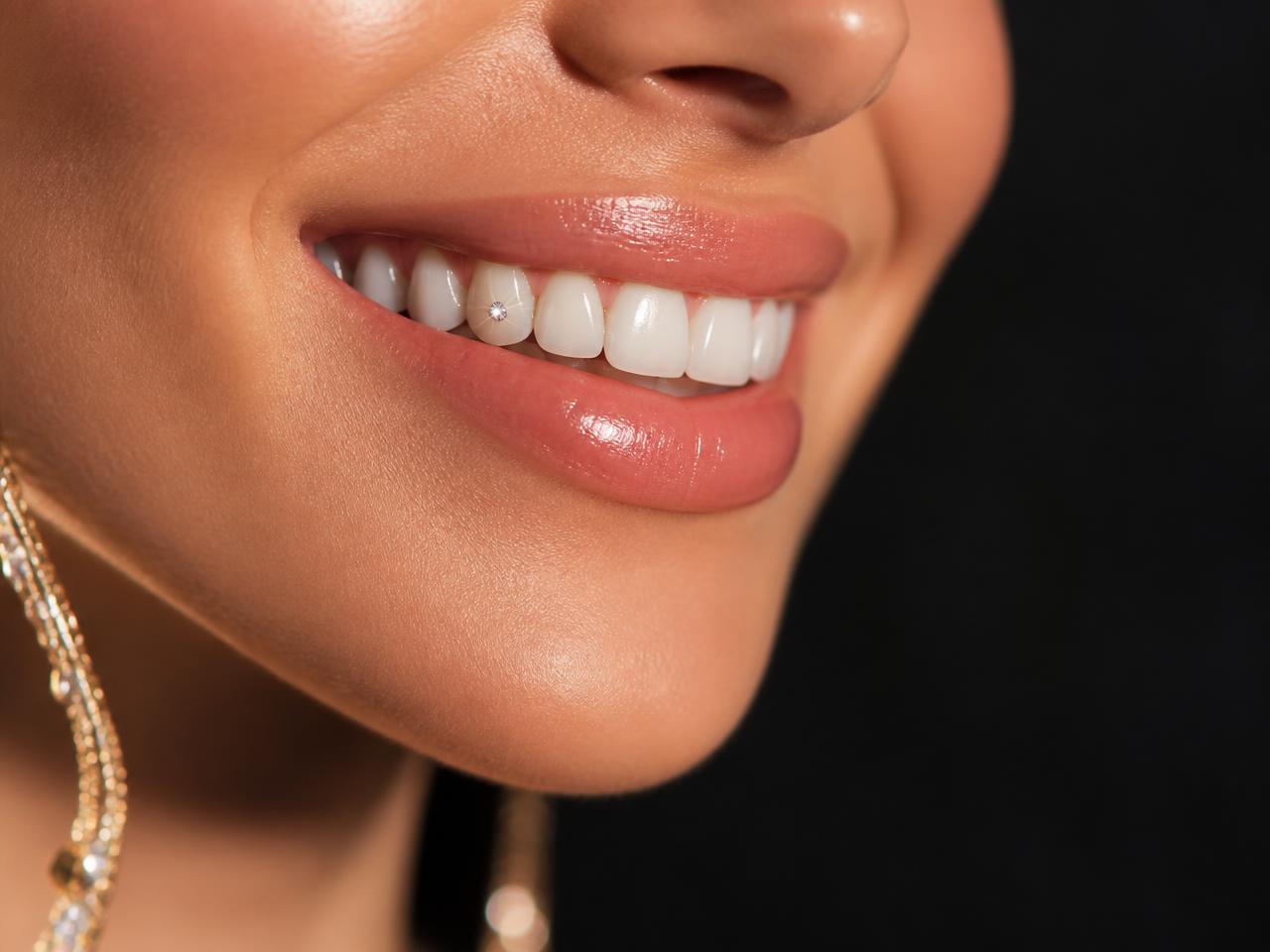 Close-up of a smile with a sparkling crystal tooth gem